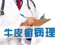 关节炎型银屑病的危害你知道吗